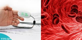 5 ნიშანი იმისა, რომ სისხლში არასაკმარისია ჟანგბადი.