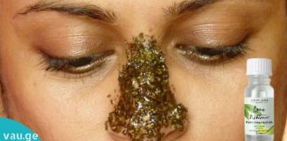 ჩაის ხის ზეთი გამონაყარის და შავი წერტილების მოცილების უმარტივესი გზაა.