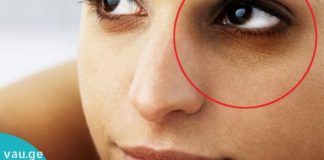 წაიკითხეთ სტატია და გაიგეთ რატომ ჩნდება თვალების ქვეშ შავი წრეები.