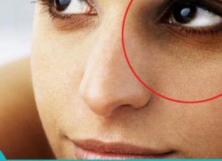 წაიკითხეთ სტატია და გაიგეთ რატომ ჩნდება თვალების ქვეშ შავი წრეები.