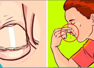 9 ნიშანი იმისა, რომ გაქვთ C ვიტამინის ნაკლებობა.