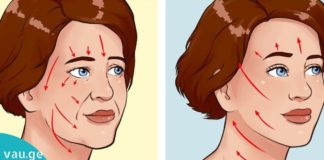 სახისა და კისრის სრულფასოვანი ლიფტინგი, 12–15 პროცედურა სახლში პირობებში