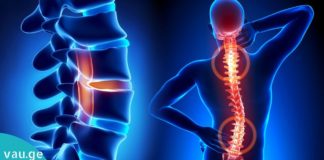 3 საიდუმლო ხილი, რომელიც აღადგენს ხერხემლის გადატვირთვას და ენერგიას.