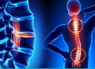 3 საიდუმლო ხილი, რომელიც აღადგენს ხერხემლის გადატვირთვას და ენერგიას.