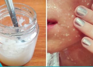 ქოქოსის ზეთი და სოდა- სახის კანის მკურნალობისთვის.