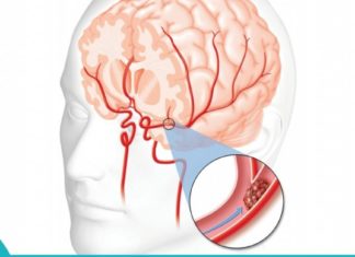 იმისათვის რომ გაიწმინდოს სისხლძარღვები, თქვენ დაგჭირდებათ: კამა, თაფლი და ვალერიანი.