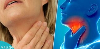 ძალიან მარტივი და სწრაფი საშუალება, რომელიც ანგინას მოგირჩენთ 4 საათში