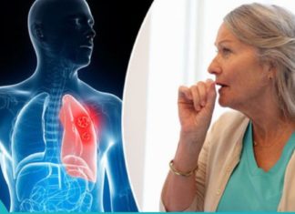 თუ ამ სიმპტომებმა შეგაწუხათ, დაუყონებლივ მიხედეთ თქვენს ფილტვებს. ის, რაც ყველამ უნდა იცოდეს!