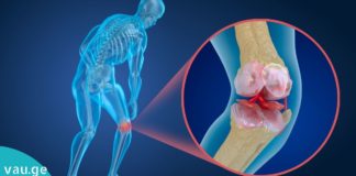 უნიკალური რეცეპტი ძვლების და სახსრების სამკურნალოდ