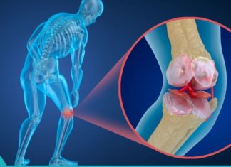 უნიკალური რეცეპტი ძვლების და სახსრების სამკურნალოდ