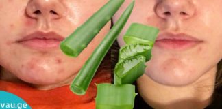 მან გამოიყენა სახეზე ალოე ვერა და ნახეთ რა მოხდა 15 წუთში?! შედეგი გაგაოცებთ!