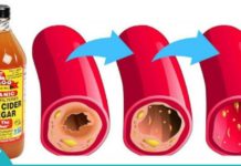 შესანიშნავი საშუალება მაღალი წნევისა და ცუდი ქოლესტერინის დროს