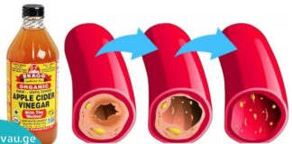 შესანიშნავი საშუალება მაღალი წნევისა და ცუდი ქოლესტერინის დროს