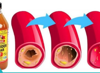შესანიშნავი საშუალება მაღალი წნევისა და ცუდი ქოლესტერინის დროს
