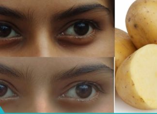 კარტოფილის და თაფლის ნიღაბი თვალებქვეშ შავი ლაქების გასაქრობად