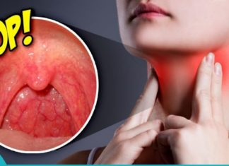 როგორ ვუმკურნალოთ ყელის ტკივილს კოჭას და თაფლის გამოყენებით?!