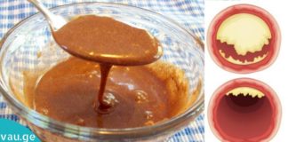 თაფლისა და დარიჩინის მაგიური კომბინაცია სასწაულებს ახდენს ჩვენს სხეულში