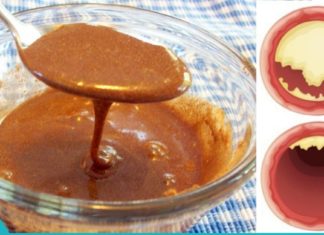 თაფლისა და დარიჩინის მაგიური კომბინაცია სასწაულებს ახდენს ჩვენს სხეულში