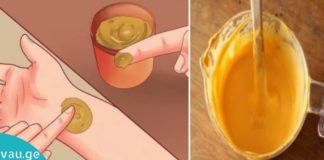 ეს რეცეფტი შეგიმსუბუქებთ სახსრების ტკივილს