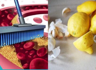 ლიმონისა და ნიორის შესანიშნავი კომბინაცია დაგეხმარებათ არტერიების გაწენდაში და აგაცილებთ გულის შეტევებს.