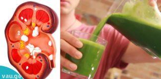 მოამზადეთ 5 წუთში: დალიეთ ეს სასმელი 5 დღის განმავლობაში და მოხდება ორგანიზმის სრული დეტოქსიკაცია და პლიუს წონის კლება