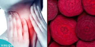 სახლში დამზადებული ჭარხლის ნაყენი ერთ დღეში აქრობს ყელის ტკივილს.