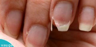 ხშირად გემტვრევათ ფრჩხილები? გინდათ გაიგოთ მიზეზი? მაშინ ეს სტატია თქვენთვისაა