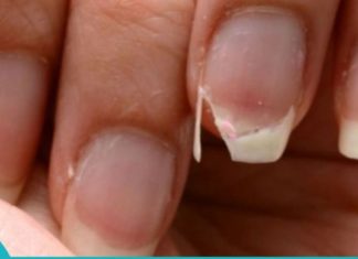 ხშირად გემტვრევათ ფრჩხილები? გინდათ გაიგოთ მიზეზი? მაშინ ეს სტატია თქვენთვისაა