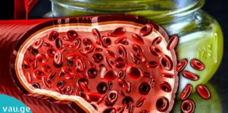 სიხლძარღვების საუკეთესო გამწმენდი მეთოდები