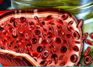 სიხლძარღვების საუკეთესო გამწმენდი მეთოდები