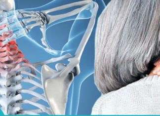 საუკეთეოსო ბუნებრივი საშუალებები კისრის ტკივილისათვის!