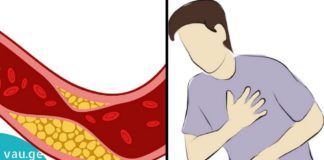 სახლში მომზადებული სასარგებლო წვენები და სმუზი ქოლესტერინის დონის შესამცირებლად