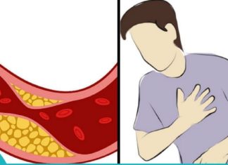 სახლში მომზადებული სასარგებლო წვენები და სმუზი ქოლესტერინის დონის შესამცირებლად