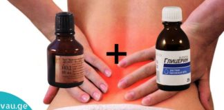 ეს რეცეპტი კურნავს ჩვეულებრივი რადიკულიტის, მიოზიტის, ადრეული ხაზებისა და შიდა ნევრალგიის დაავადებებს