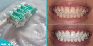 უსაფრთხო კბილების გათეთრება ორი ინგრედიენტით