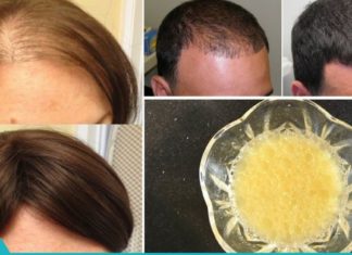 შეიზილეთ ეს მარევი თმის ძირებში და დაივიწყეთ თმის ცვენა