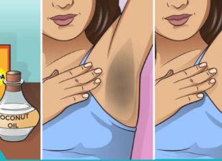 იღლიის გათეთრება სახლის პირობებში