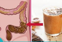 ეს საოცარი რეცეპტი გამოდევნის ტოქსინებს ნაწლავიდან და სისხლძარღვებიდან!