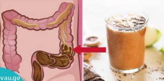 ეს საოცარი რეცეპტი გამოდევნის ტოქსინებს ნაწლავიდან და სისხლძარღვებიდან!