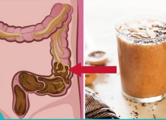 ეს საოცარი რეცეპტი გამოდევნის ტოქსინებს ნაწლავიდან და სისხლძარღვებიდან!