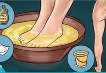 საჯდომის ნერვის მკურნალობა სახლის პირობებში