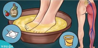 საჯდომის ნერვის მკურნალობა სახლის პირობებში