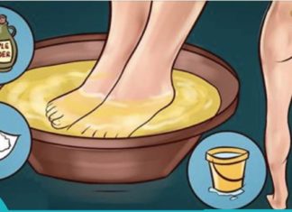 საჯდომის ნერვის მკურნალობა სახლის პირობებში