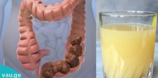 ნატურალური წამალი ნაწლავების გაწმენდისა და საჭმლის მონელების გასამარტივებლად.