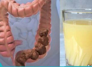 ნატურალური წამალი ნაწლავების გაწმენდისა და საჭმლის მონელების გასამარტივებლად.