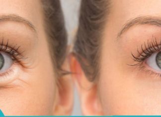 განსაცვიფრებელი რეცეპტი თვალების ქვეშ შეშუპების მოსაშორებლად