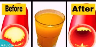 სისხლძარღვების გაწმენდა სელის ნაყენით