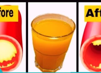 სისხლძარღვების გაწმენდა სელის ნაყენით