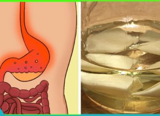 დაამარცხეთ ბუასილი და გასტრიტი ამ “ტიბეტური მედიცინის” სასმელით