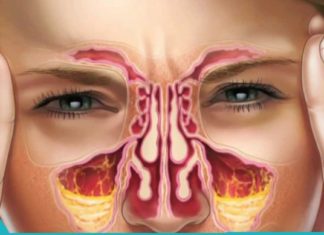 როგორ მოვირჩინოთ ჰაიმორიტი შავი ჩაით?!